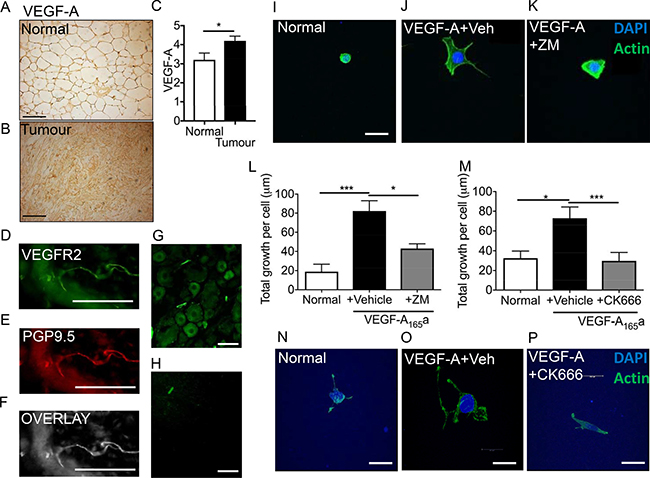 VEGF-A induced sensory neurogenesis mediated by VEGFR2-ARP2/3.