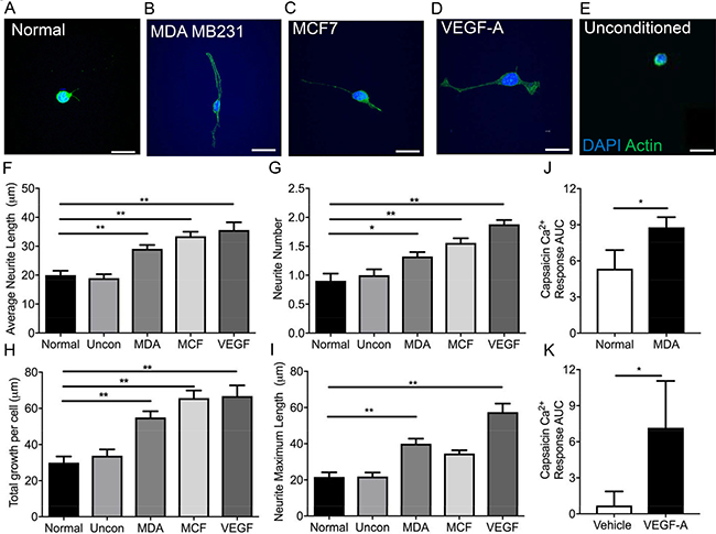 MDA MB231 and MCF7 breast cancer cell lines induce sensory neuronal growth.