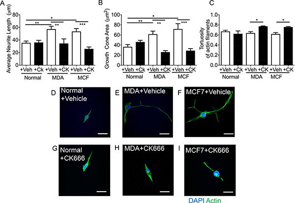 CK666 inhibited sensory neuritogenesis induced by both MDA-MB-231 and MCF7.