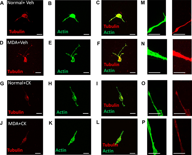 MDA MB231 induced mature sensory axonal neurite formation via ARP2/3.