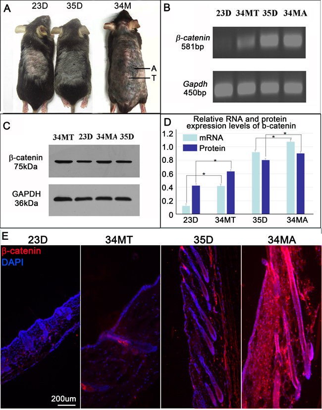 &#x3b2;-catenin expression is increased skin of aged mice.