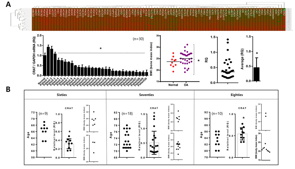 Peroxisomal gene profiling in normal and osteoarthritis chondrocytes.