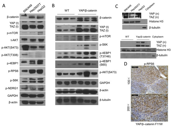 mTORC1 is activated in human hepatoblastoma (HB) cells and YAP/&#x3b2;-catenin driven HB lesions.