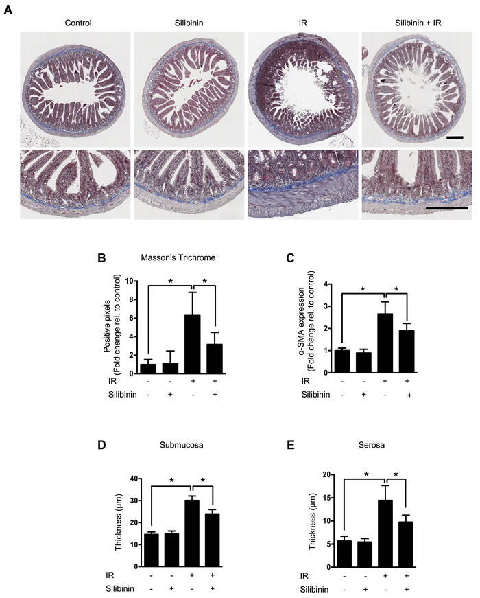 The effect of silibinin on radiation-induced intestinal fibrosis.