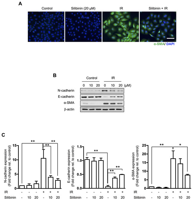 The effect of silibinin on radiation-induced EMT in IEC6 cells.