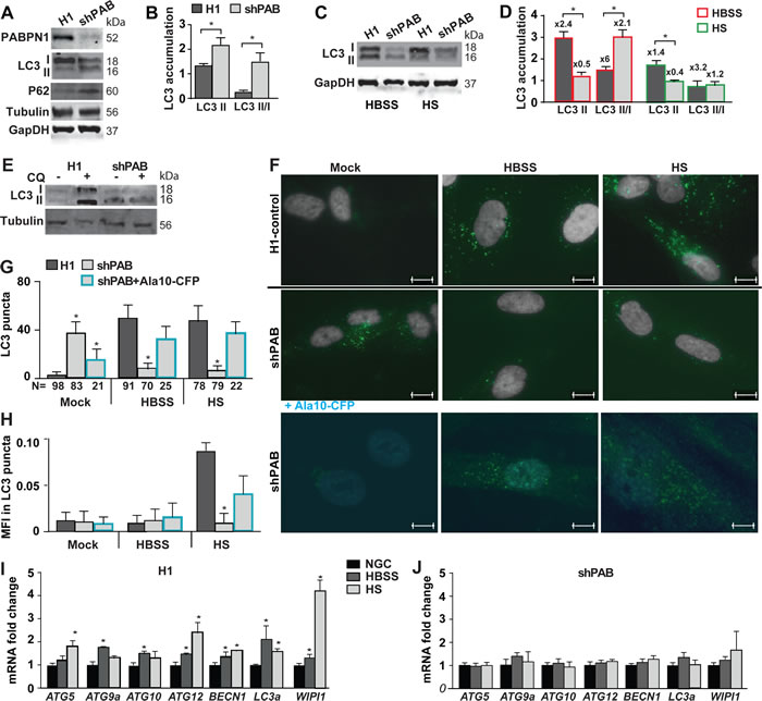 Reduced PABPN1 availability impairs autophagy in human muscle cell cultures.