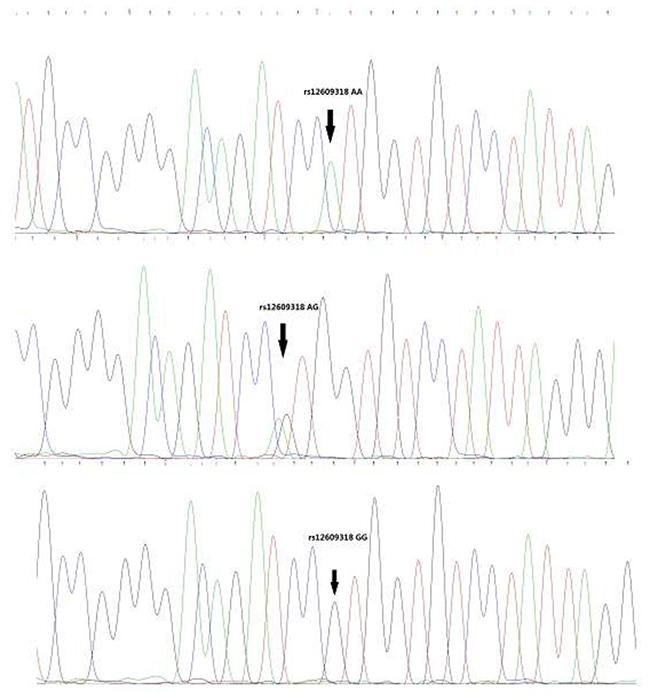 Representative sequencing results of rs12609318.