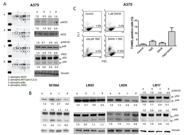 Tumor cell response to temozolomide, SAHA or their combination in human melanoma cell lines.