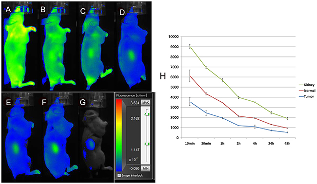 In vivo fluorescence imaging of subcutaneous MHCC-LM3 tumour-bearing nude mice in the blocked group.