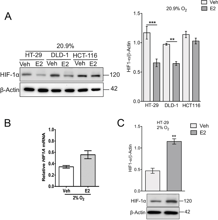 Oxygen tension and estradiol modulate HIF1-&alpha; expression in colon cancer cells.