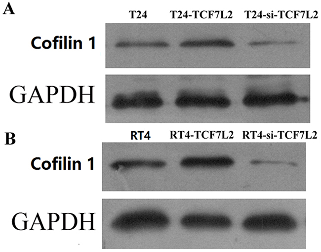 Cofilin 1 protein expression in control, TCF7L2, and si-TCF7L2 group T24 and RT4 cells were detected by WB.