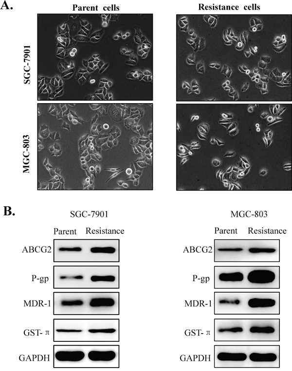 Morphological changes and drug resistance related proteins expression in the parental gastric cancer cells and its 5-fluorouracil resistant cell lines.