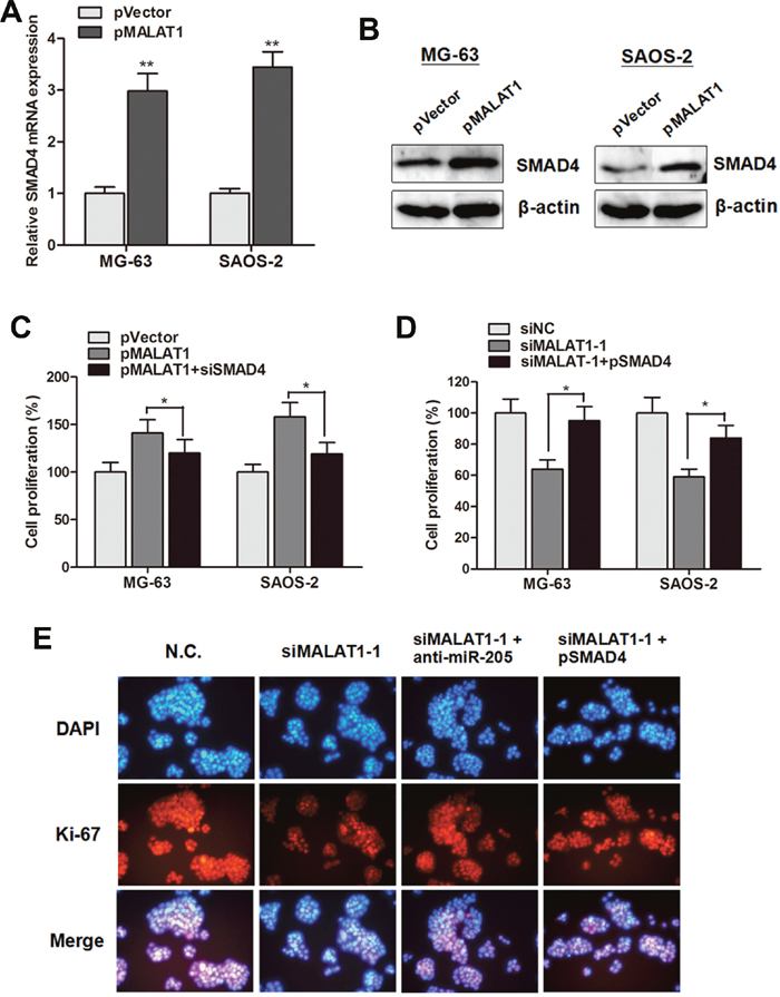 MALAT1 promoted cell growth through suppressing miR-205 and promoting SMAD4 expression.