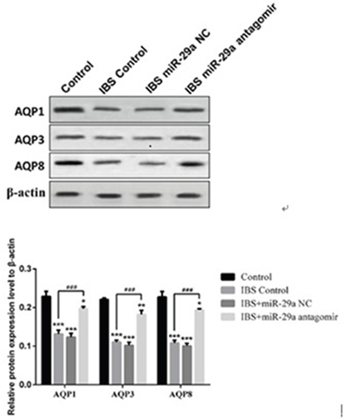 MiRNA-29a regulated AQP1, AQP3, AQP8 in the colonic epithelial cells of IBS-D.