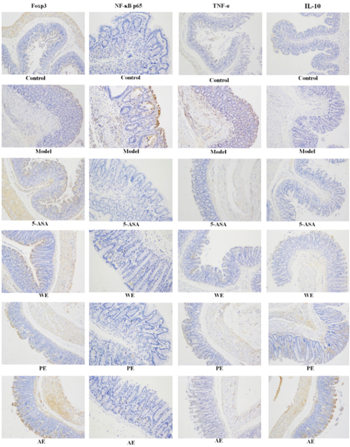 Immunohistochemistry staining of Foxp3, NF-&#x03BA;B p65, TNF-&#x03B1;, and IL-10 in the colons of different experimental groups (&#x00D7;200) in IBD rats.