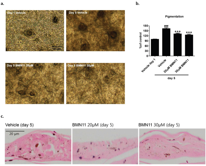 Inhibition of melanin accumulation by BMN11 in a human skin model.