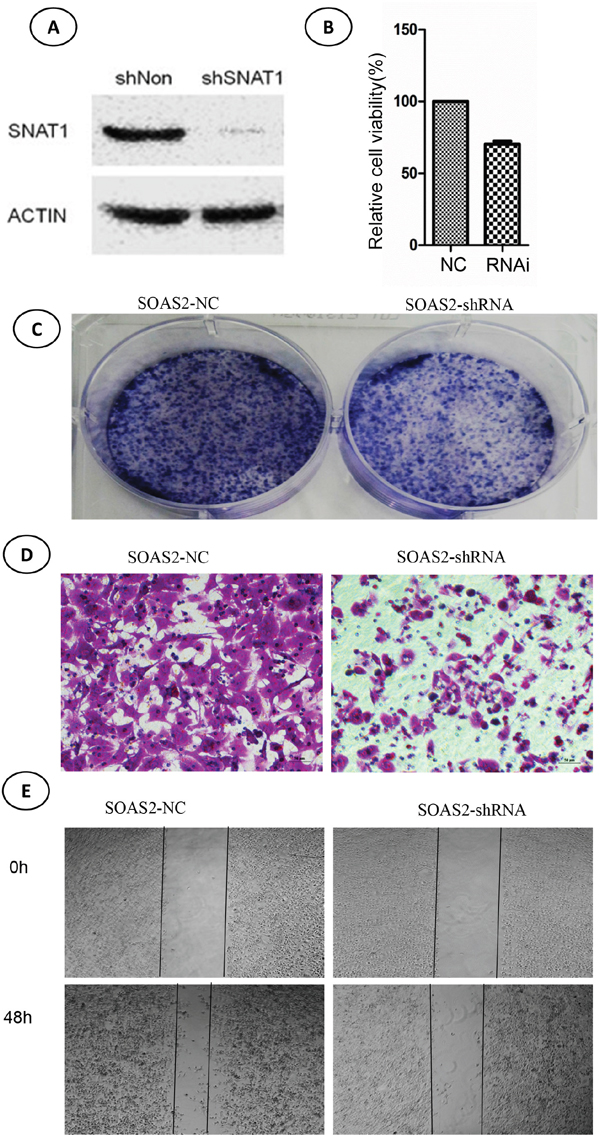 Effects of SNAT-shRNA on cell viability, colony formation, and migration in soas-2 cell lines.