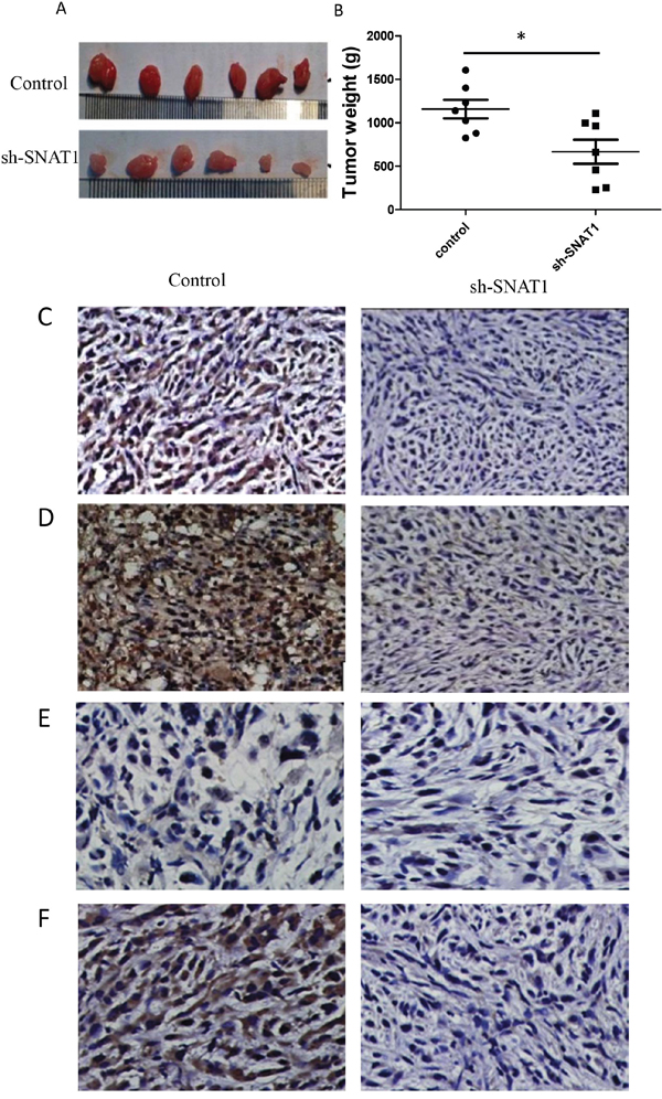 Silencing SNAT1 inhibited tumor growth in vivo.