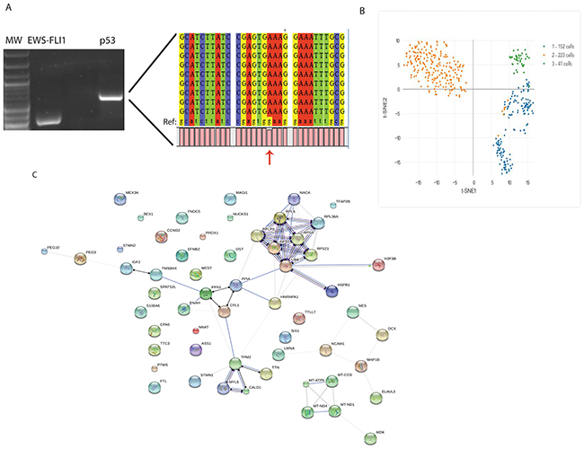 Molecular analysis of CTC from a Ewing sarcoma patient.