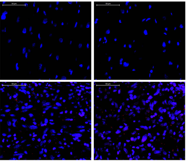 Detection of phosphorylated