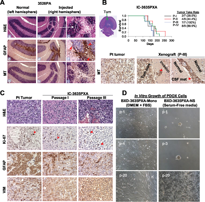 Establishment of in vivo and in vitro models of PLGGs.