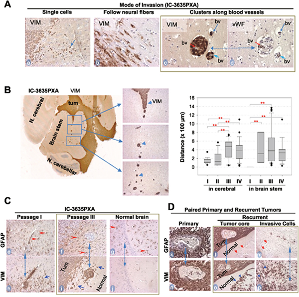 In vivo tumor invasion and host responses detected with IHC.