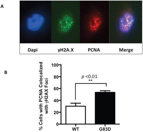 PCNA and &#x03B3;H2AX foci colocalize in cells expressing NEIL1 G83D.