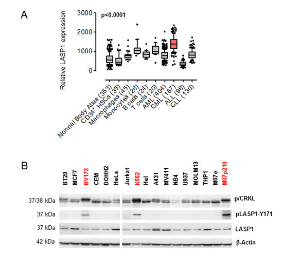 LASP1 is overexpressed in CML and phosphorylated at Tyr-171 in leukemia cell lines.