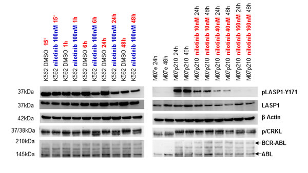 Phosphorylation of LASP1 and CRKL is inhibited by the tyrosine kinase inhibitor nilotinib.