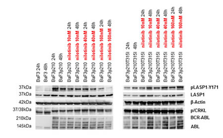 LASP1 and CRKL are phosphorylated by BCR-ABL-kinase .