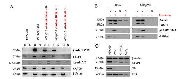 In CML cells LASP1 is not localized in the nucleus.