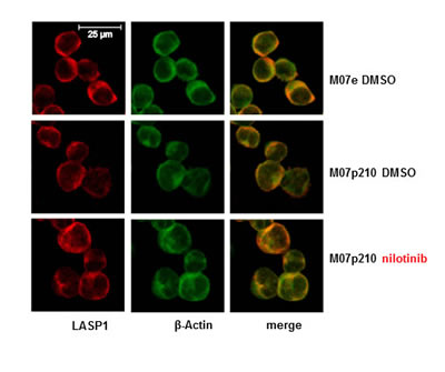Immunofluorescence of LASP1 in Mo7e and M07p210 cells.