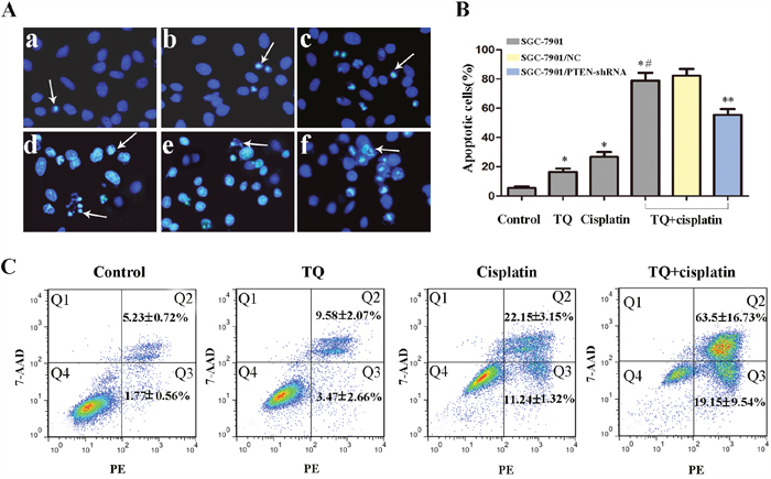 Effects of TQ and/or cisplatin on inducing apoptosis of GC cells by Hoechst 33258 and flow cytometry.