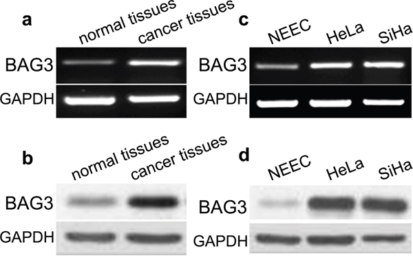 Expression of BAG3 in cervical cancer tissues and cells.