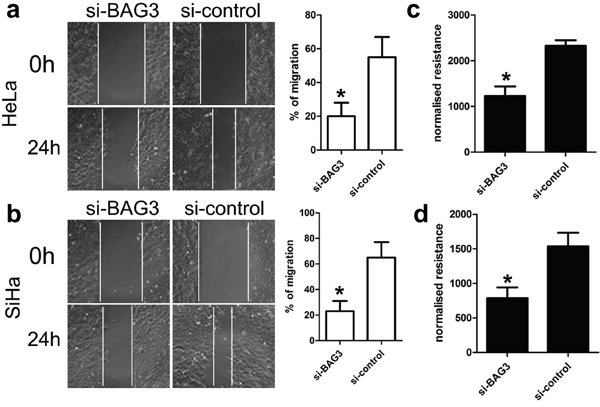 Effect of BAG3 expression on migration of HeLa and SiHa cells.