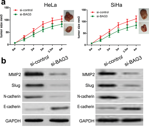 Knockdown of BAG3 suppresses HeLa and SiHa cell growth in nude mice.