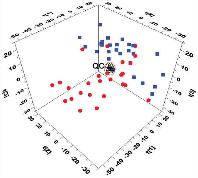Three-dimensional PCA score plots based on the data from UHPLC-Q-TOFMS separation (&#x25A0; CR patients, &#x25CF; NR patinets, &Delta;QC).