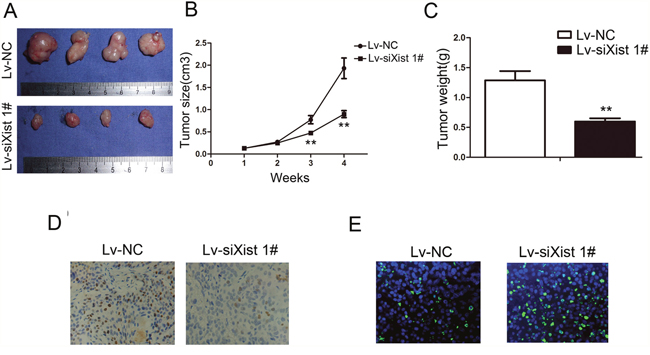 Suppressing Xist inhibits tumorigenicity and proliferation in vivo.