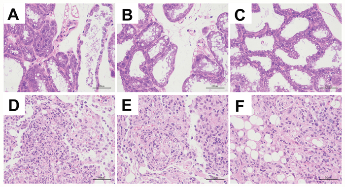 Se prevented the histopathological changes of mammary tissues from S. aureus-infected mastitis model mice.