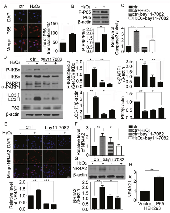 NR4A2 was regulated by NF-&kappa;B directly in H2O2-induced autophagy and apoptosis of CSCs.
