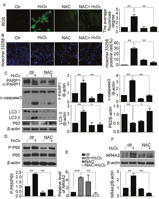 ROS was the upstream of NF-&kappa;B/NR4A2 in H2O2-induced autophagy and apoptosis in CSCs.