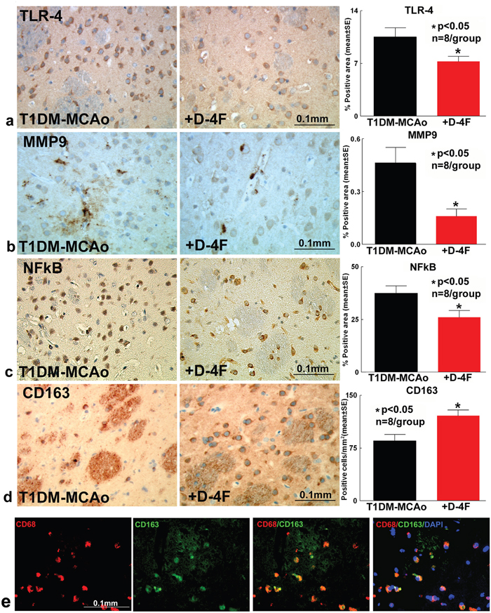 D-4F treatment of stroke in T1DM rats significantly decreases inflammatory factor expression and promotes M2 macrophage polarization in the ischemic brain.