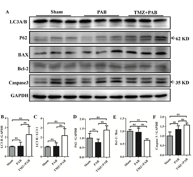 Detection of autophagy and apoptosis pathway by Western blot in each group.