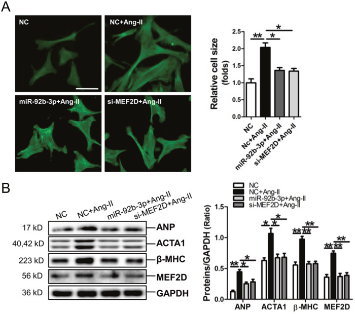 MicroRNA-92b-3p (miR-92b-3p) suppresses the hypertrophic phenotype of NMVCs in vitro.