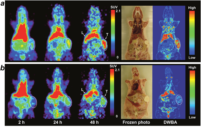 Small animal PET imaging of 64Cu-PCTA-cetuximab in SNU-1066 HNSCC xenograft model.