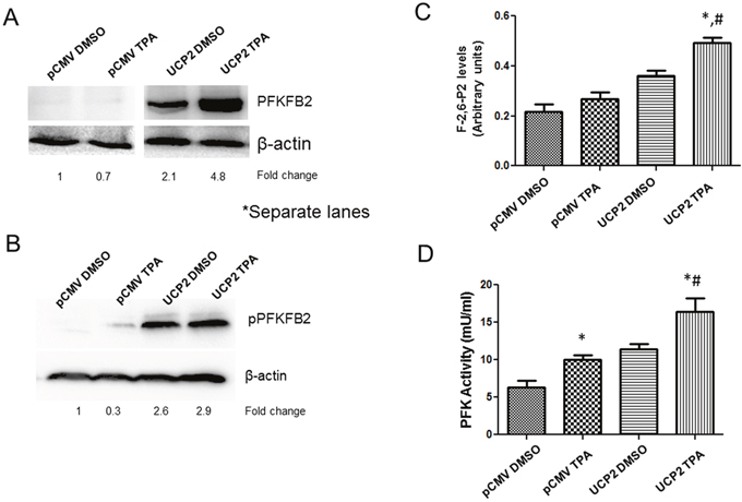 Upregulation of PFKFB2 expression in UCP2 overexpressed cells.