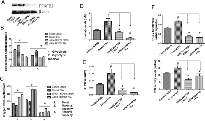 Inhibition of PFKFB2 expression dampens the shift to glycolysis in UCP2 overexpressed cells.