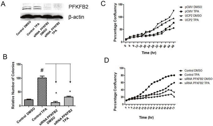 siRNA knockdown of PKFKB2 suppressed skin tumorigenesis in UCP2 overexpressed cells.