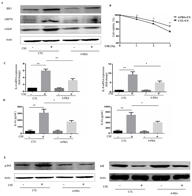 4-PBA prevents CSE-induced inflammatory responses in Beas-2B cells through inhibiting NF-&#x03BA;B signaling.