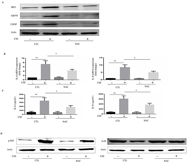 Role of N-acetylcysteine (NAC) in CSE-induced ER stress and inflammatory responses.